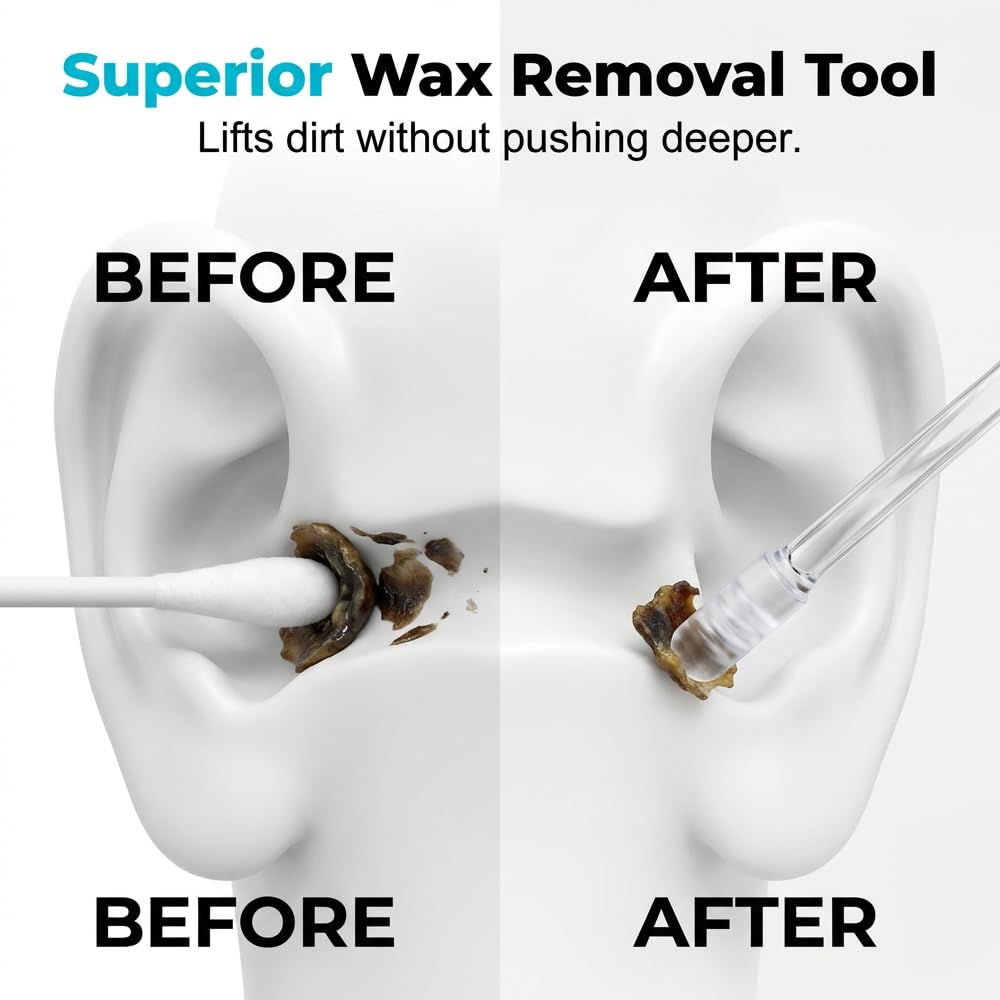 🥳2026 HOT SALE🥳💞50K+ SOLD!🧏‍♂️🌿 50% OFF! Reusable Earwax Remover – Soft adhesive tip, no cotton mess. Simple & gentle for seniors. Keep ears clean & comfortable. 🤲💚