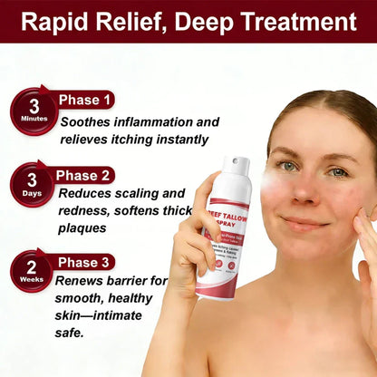 Beef Tallow Spray — The No-Rub Relief for Psoriasis-Prone Skin✨