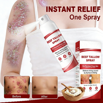 Beef Tallow Spray — The No-Rub Relief for Psoriasis-Prone Skin✨