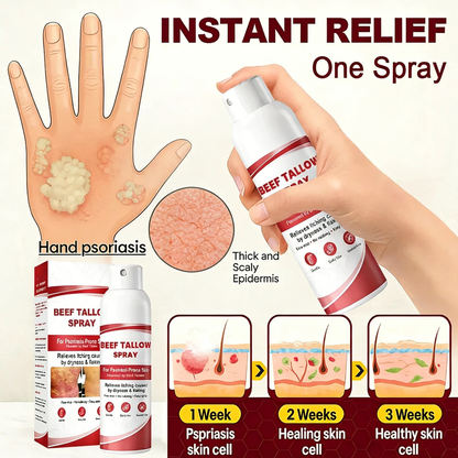 Beef Tallow Spray — The No-Rub Relief for Psoriasis-Prone Skin✨
